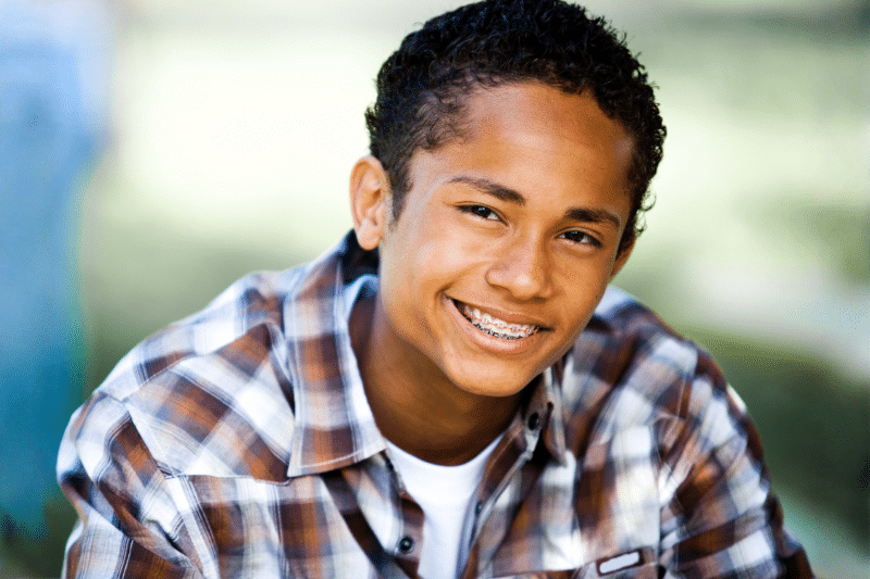 Surgical orthodontics at Advanced Orthodontics in Everett, WA 98208 correcting severe bite and jaw alignment issues
